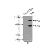 GLS Rabbit Polyclonal Antibody (12855-1-AP)