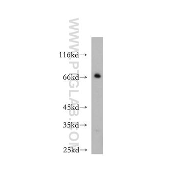 BVES Rabbit Polyclonal Antibody (12920-1-AP)