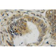 LGALS2 Rabbit Polyclonal Antibody (12849-2-AP)