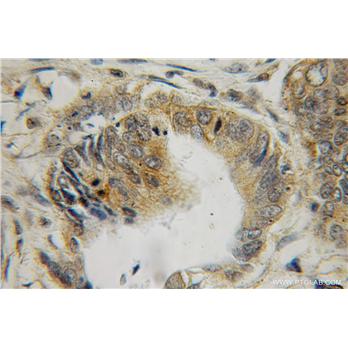 LGALS2 Rabbit Polyclonal Antibody (12849-2-AP)