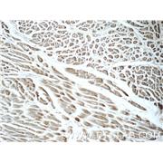 FBXO17 Rabbit Polyclonal Antibody (12844-1-AP)