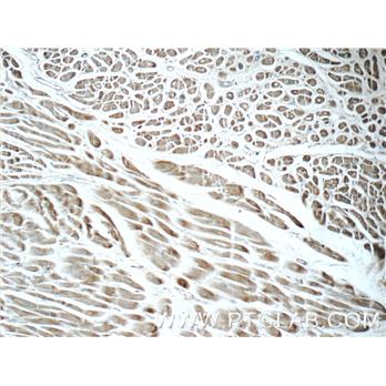 FBXO17 Rabbit Polyclonal Antibody (12844-1-AP)