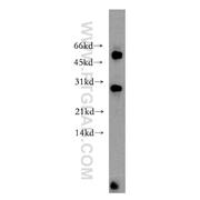 LRAT Rabbit Polyclonal Antibody (12815-1-AP)