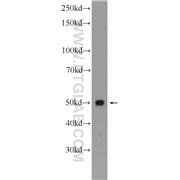 SEPT6 Rabbit Polyclonal Antibody (12805-1-AP)