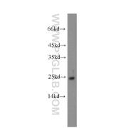 GUCA1A Rabbit Polyclonal Antibody (12944-1-AP)