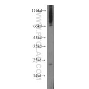 ARL6IP1 Rabbit Polyclonal Antibody (12988-1-AP)