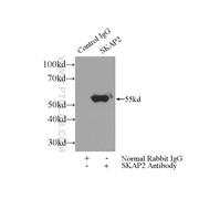 SKAP2 Rabbit Polyclonal Antibody (12926-1-AP)