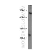 PHYH Rabbit Polyclonal Antibody (12858-1-AP)