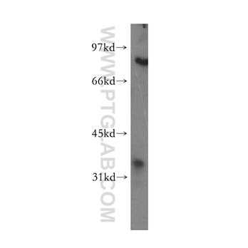 PHYH Rabbit Polyclonal Antibody (12858-1-AP)