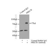 PRKCB Rabbit Polyclonal Antibody (12919-1-AP)