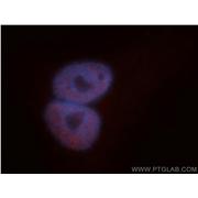 TARDBP Rabbit Polyclonal Antibody (12892-1-AP)