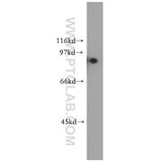 TRIM37 Rabbit Polyclonal Antibody (13037-1-AP)