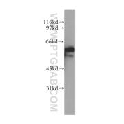 ETV5 Rabbit Polyclonal Antibody (13011-1-AP)