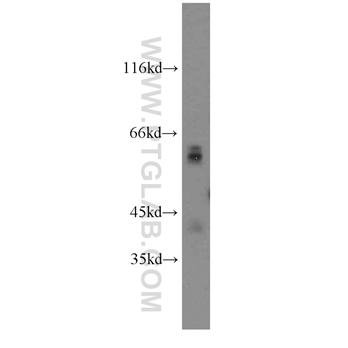 GPC4 Rabbit Polyclonal Antibody (13048-1-AP)