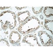 SPACA1 Rabbit Polyclonal Antibody (12829-1-AP)
