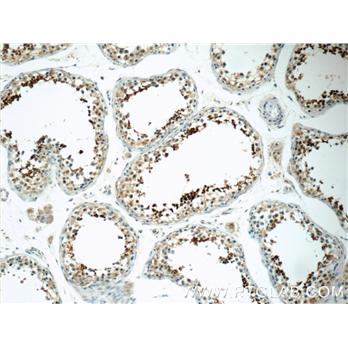 SPACA1 Rabbit Polyclonal Antibody (12829-1-AP)