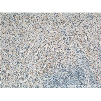 GP1BA Rabbit Polyclonal Antibody (12860-1-AP)