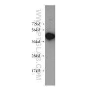 KRR1 Rabbit Polyclonal Antibody (12772-1-AP)