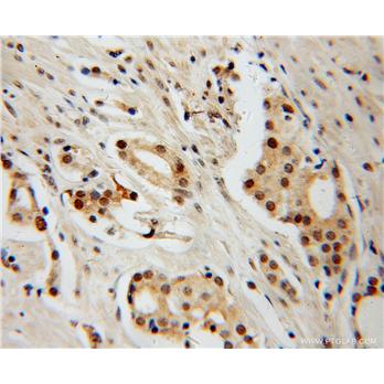 HDAC2 Rabbit Polyclonal Antibody (12922-3-AP)