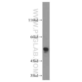 RAD9A Rabbit Polyclonal Antibody (13035-1-AP)