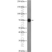 DNM1L Rabbit Polyclonal Antibody (12957-1-AP)