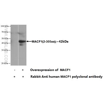 MACF1 Rabbit Polyclonal Antibody (13058-1-AP)