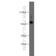 CRTAC1 Rabbit Polyclonal Antibody (13001-1-AP)