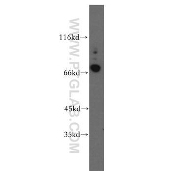CRTAC1 Rabbit Polyclonal Antibody (13001-1-AP)