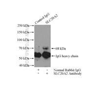SLC20A2 Rabbit Polyclonal Antibody (12820-1-AP)
