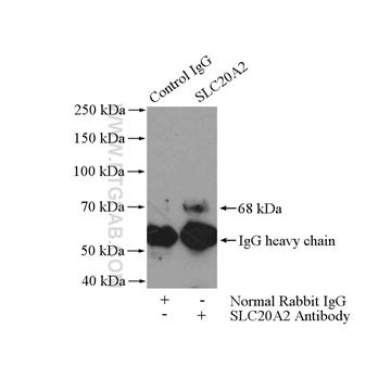 SLC20A2 Rabbit Polyclonal Antibody (12820-1-AP)