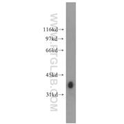 GYG1 Rabbit Polyclonal Antibody (12836-1-AP)