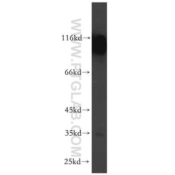 PCDHA6 Rabbit Polyclonal Antibody (12853-1-AP)