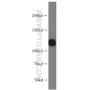 CP110 Rabbit Polyclonal Antibody (12780-1-AP)