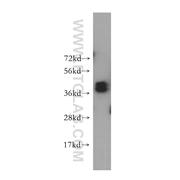 HNRNPD Rabbit Polyclonal Antibody (12770-1-AP)