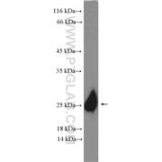 CLDN1 Rabbit Polyclonal Antibody (13050-1-AP)