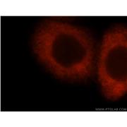 IMPDH2 Rabbit Polyclonal Antibody (12948-1-AP)