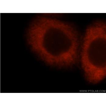IMPDH2 Rabbit Polyclonal Antibody (12948-1-AP)