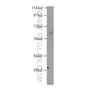 MLLT3 Rabbit Polyclonal Antibody (12825-1-AP)