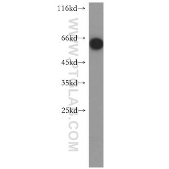 ENTPD3 Rabbit Polyclonal Antibody (13021-1-AP)