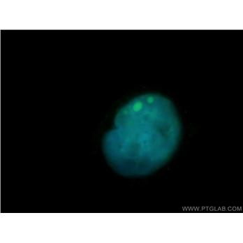 SMARCD3 Rabbit Polyclonal Antibody (12838-1-AP)