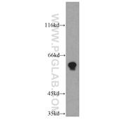 TPTE Rabbit Polyclonal Antibody (12982-1-AP)