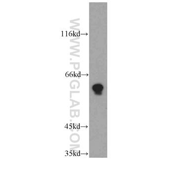 TPTE Rabbit Polyclonal Antibody (12982-1-AP)