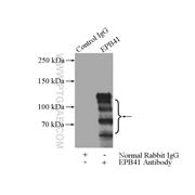 EPB41 Rabbit Polyclonal Antibody (13014-1-AP)