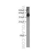 GIPC2 Rabbit Polyclonal Antibody (12832-1-AP)