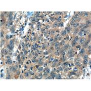 ITPKB Rabbit Polyclonal Antibody (12816-1-AP)