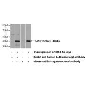 CA10 Rabbit Polyclonal Antibody (12953-1-AP)