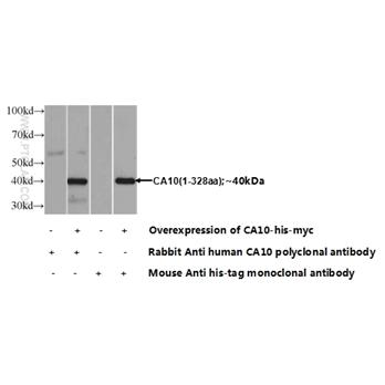 CA10 Rabbit Polyclonal Antibody (12953-1-AP)