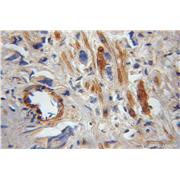 FAIM Rabbit Polyclonal Antibody (13005-1-AP)