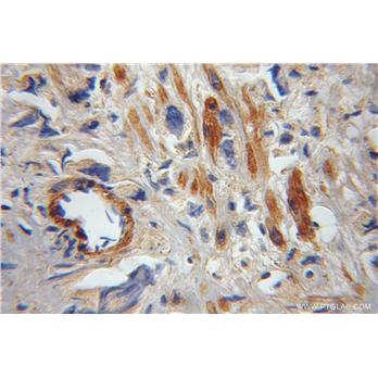 FAIM Rabbit Polyclonal Antibody (13005-1-AP)