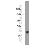 SH2D3C Rabbit Polyclonal Antibody (12882-1-AP)